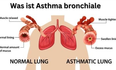 Was ist Asthma bronchiale und welche Symptome treten auf?