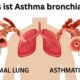 Was ist Asthma bronchiale und welche Symptome treten auf?