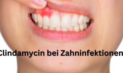 Clindamycin bei Zahninfektionen: Was man wissen sollte