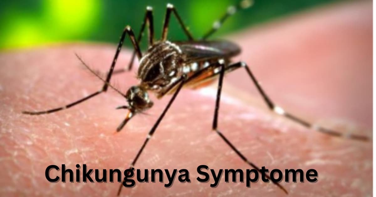 Quels sont les Chikungunya Symptome :Causes, diagnostic et traitement