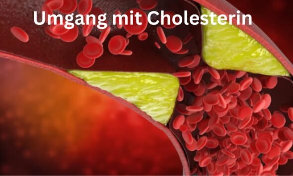 Umgang mit Cholesterin: Tipps, um es in Ihrer Ernährung