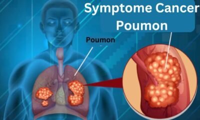 Qu'est-ce que le Symptome Cancer Poumon ? Causes, Diagnostic