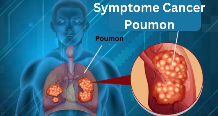 Qu'est-ce que le Symptome Cancer Poumon ? Causes, Diagnostic