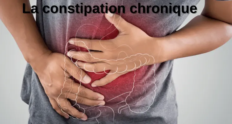 La constipation chronique : symptômes, solutions et traitements